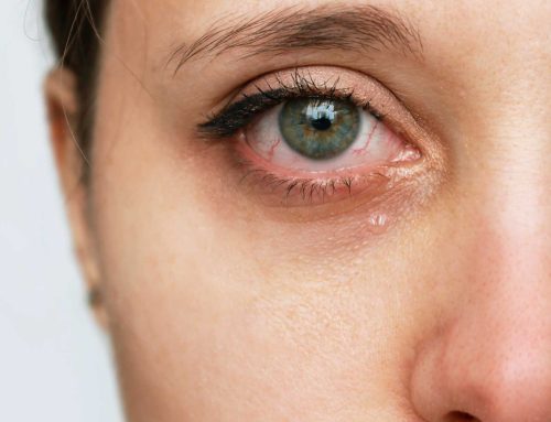 Understanding the Different Types of Dry Eye